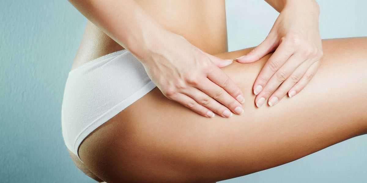 A Comprehensive Guide to Cellulite Reduction Cavitation in Los Angeles